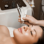 Tratamiento Contorno de ojos con Microneedling