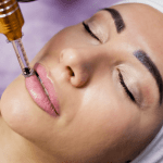 Tratamiento hidratación de labios y zona peribucal